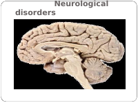 neurological disorder.ppt